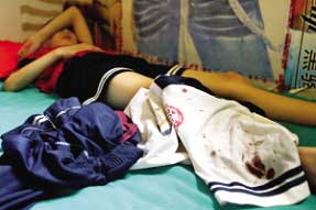 小学生课堂讲话遭老师猛打<em>流血不止</em>_小小资讯