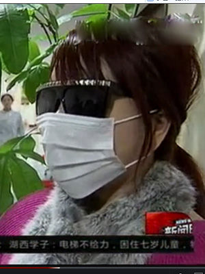 红粉宝宝整容200次受蚕食 红粉宝宝整容200次受蚕食