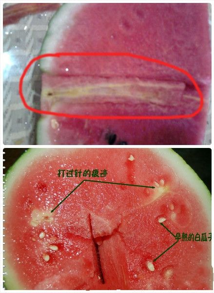 网传“打针西瓜”破坏肾功 教你识别好坏西瓜