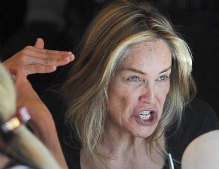 女星纷现鱼尾纹 要去除还得看动静