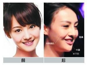 曝光<em>假脸姐妹团</em>女星<em>整容前后</em>照|<em>假脸姐妹团</em>|