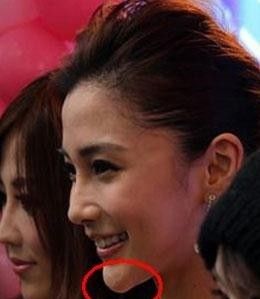 Angelababy旧素颜照大曝光酷似凤姐 |Angelababy|明星整容照|杨颖_新浪女性_新浪网