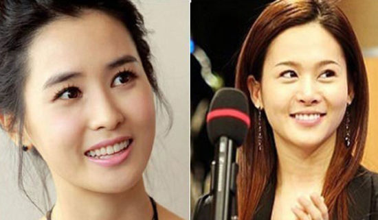 整容过度的女星,整容过度的女星是谁