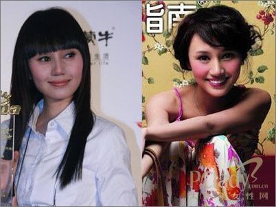 明星整容过度遭毁容 失败后对比照|明星整容失