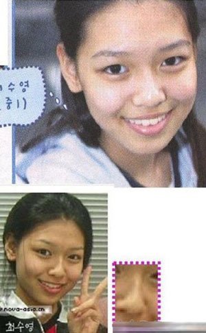 <em>少女时代</em>全团<em>整容</em>对比照 林允儿动工最大|<em>少女</em>