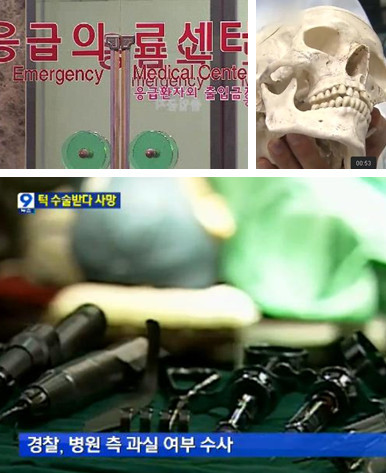 磨骨手术后遗症频发 韩国现新一例致死案