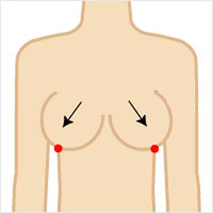渊腋：令胸部更坚挺更有张力