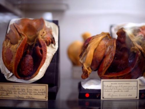 让你吓破胆 走进法国另类畸形博物馆