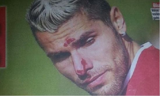 �������ױ������Ѫ��