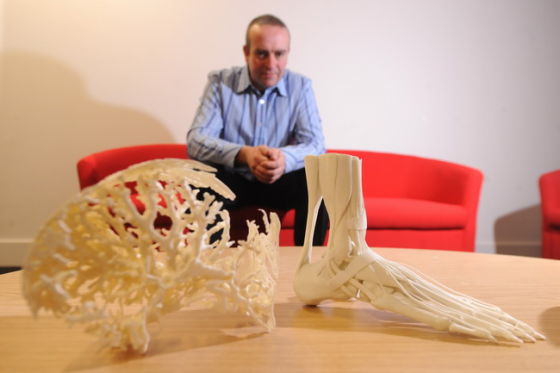 3d生物打印开启造物新纪元:打印器官移植