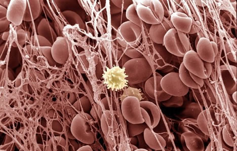 显微镜下的精美画面:人类汗腺如同玫瑰花蕊_科学探索_科技时代_新浪网