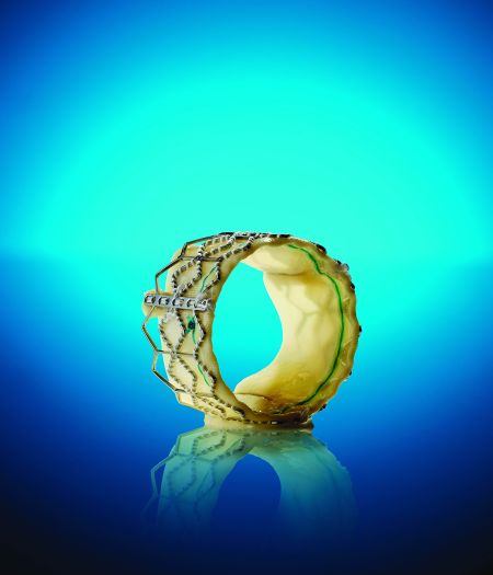 sapien经导管人工心脏瓣膜