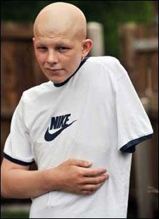 英国医生用肘部为截肢男孩再造肩膀图