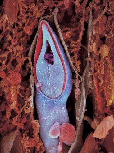 精子发育成胎儿过程超清晰照片