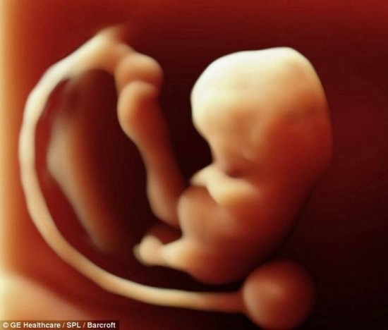 怀孕6个周的胎儿3d超声波扫描图像