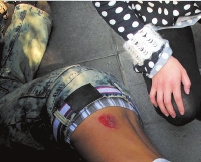 4.伤者腰部有明显伤口.