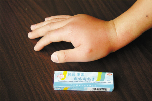 红火蚁入侵蜇人畜咬设施毁生态