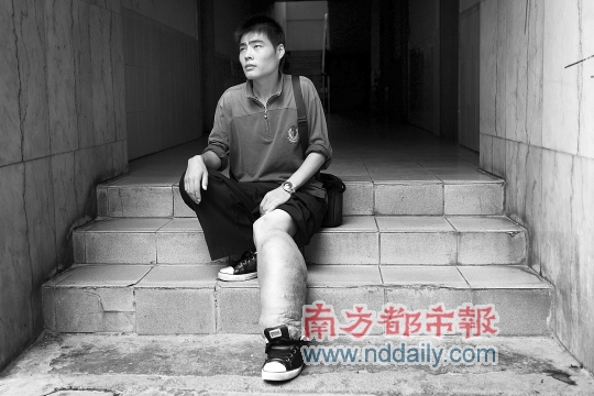 小腿粗过腰 小伙截肢也愿意 毕新龙患左下肢血管瘤,努力自学想打工