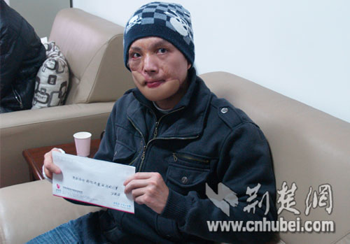 华中"换脸"第一人石祺祥为海地捐款