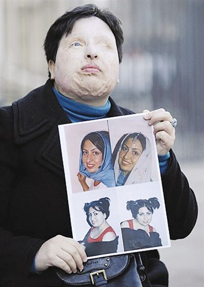 法庭判决以眼还眼