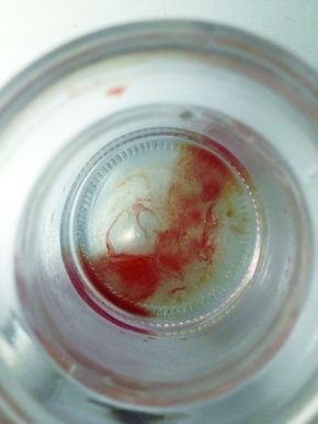 媒体实验证实滴血认亲不靠谱:陌生人血液也相融