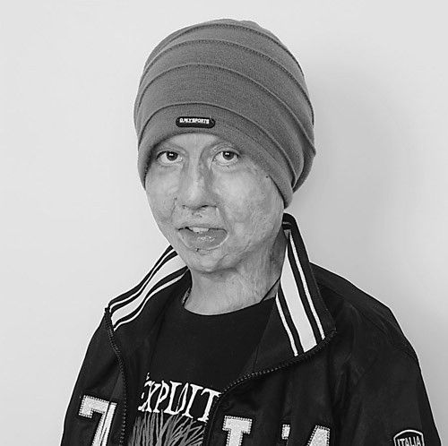 艾山江与双胞胎弟弟(资料图)如果可能,23岁的艾山江希望自己能像