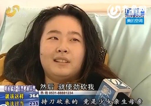 山東一少女慘遭親生母親毀容 挑斷三根手筋(圖)