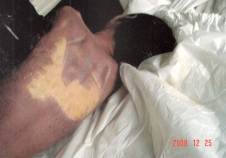 少年服刑期间死亡 家属称遗体浑身青紫