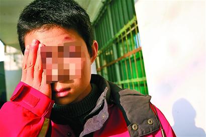 泺口中学)一名中学生被三名辍学学生和一名在校生用拳脚和棒球棍打伤