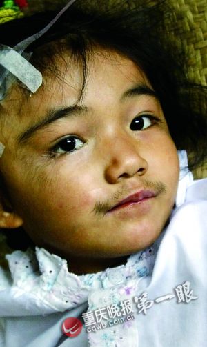 5岁女童全身长黑毛遭父母遗弃:我不是怪物(图)