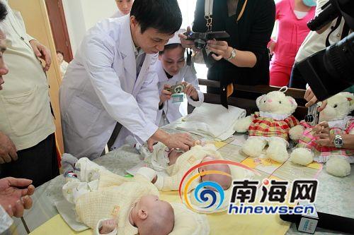 广州中山大学附属第一医院外科主治医生刘钧澄查看双胞胎姐妹薛云
