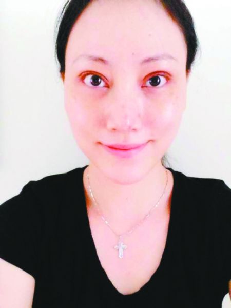 不惧流言,乔维怡晒术后恢复照片