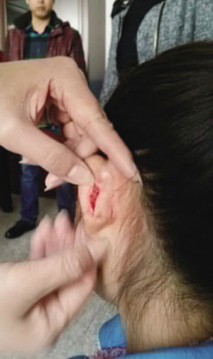 拽伤学生耳朵老师自杀未果