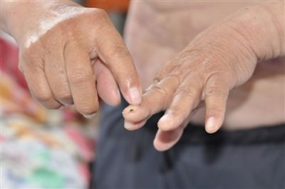 老人被疑与儿媳有染遭儿子烫烙铁钉竹签8小时(图)