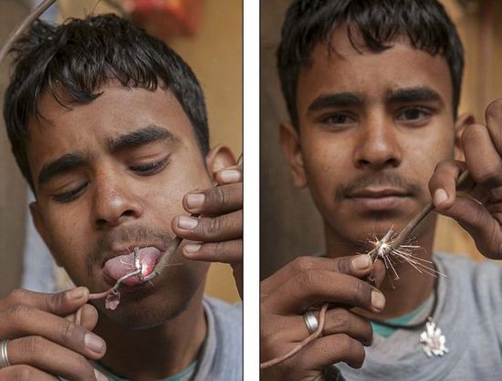 印度奇迹男孩可抗11000伏电击组图