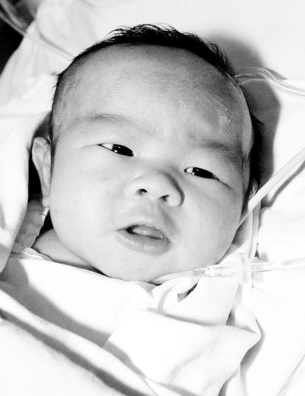 双性婴儿无钱定"性"