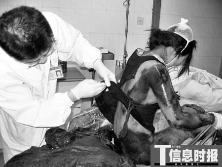 女子遭劫头发被卷摩托后轮强拖数百米(图)