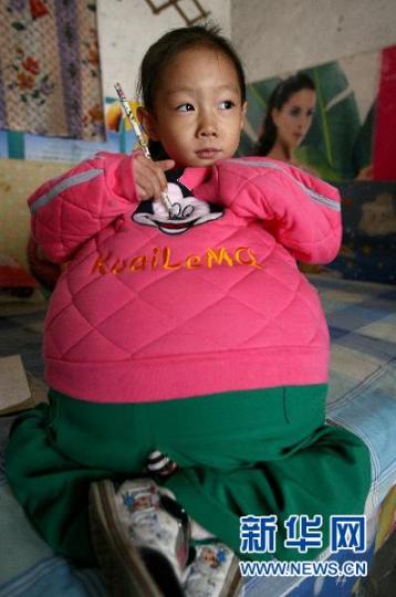女童肚子大过孕妇赴京治疗续因暂不宜手术转院