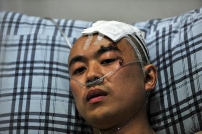 2011年8月21日,头部受伤的陈涛躺在病床上本报资料图片