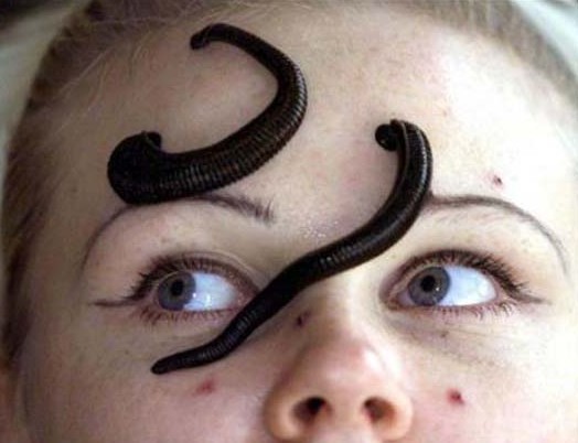 500条水蛭吸血治子宫瘤 英45岁妇女成功怀孕