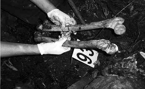 抽脂杀人案造假 秘鲁警队蒙羞