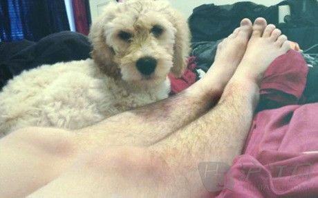 奇葩风潮:欧美兴起晒腿毛革命(双语)