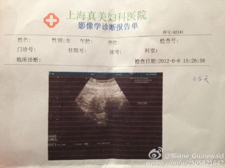 怀孕15天b超图片高清图片