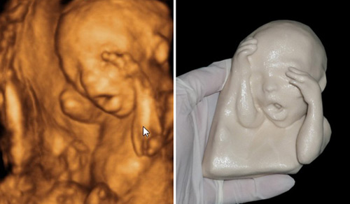 21周胎儿图片