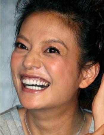 赵薇赵薇赵薇出道时有一口中度四环素牙,虽然整齐颜色却不甚美观,看看